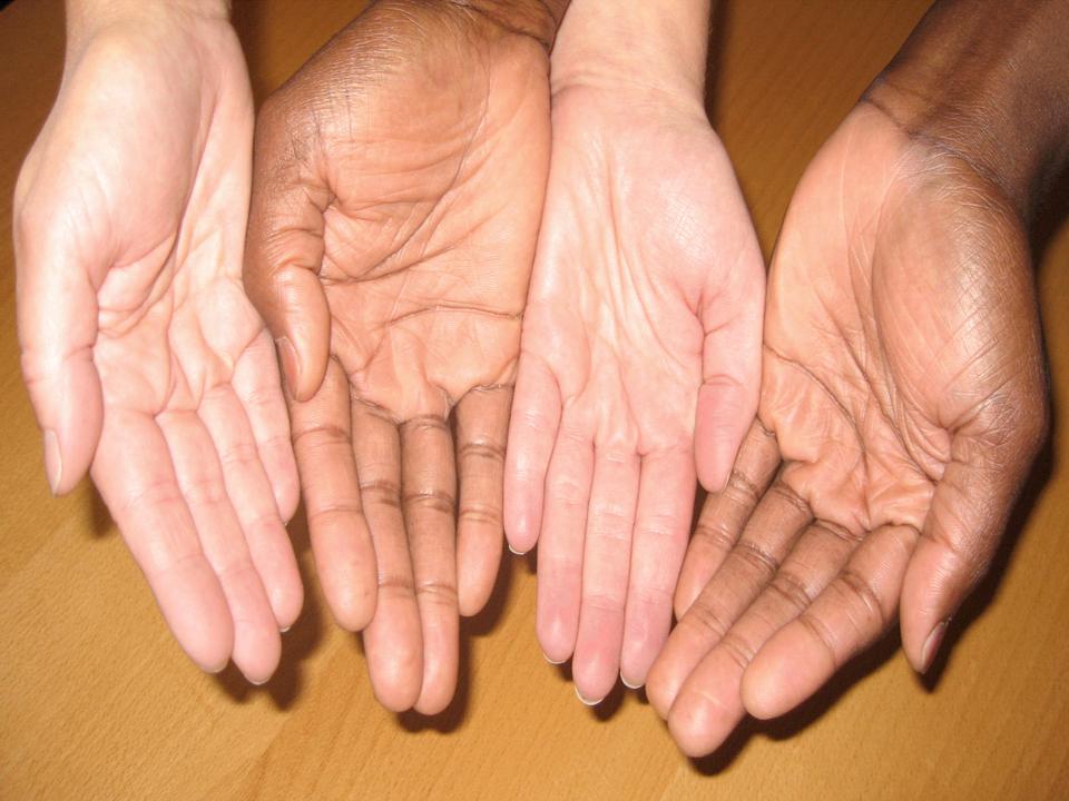 begging hands